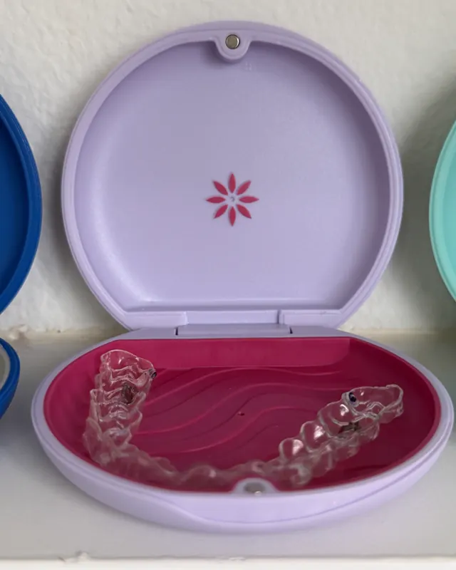 Estuche lila de Invisalign abierto, con un par de alineadores adentro