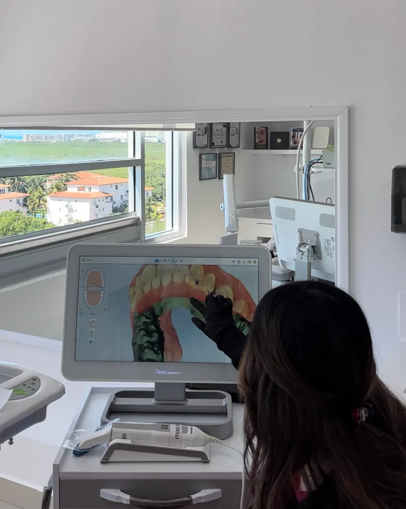 La doctora revisando un escaneo 3D en el iTero de su consultorio
