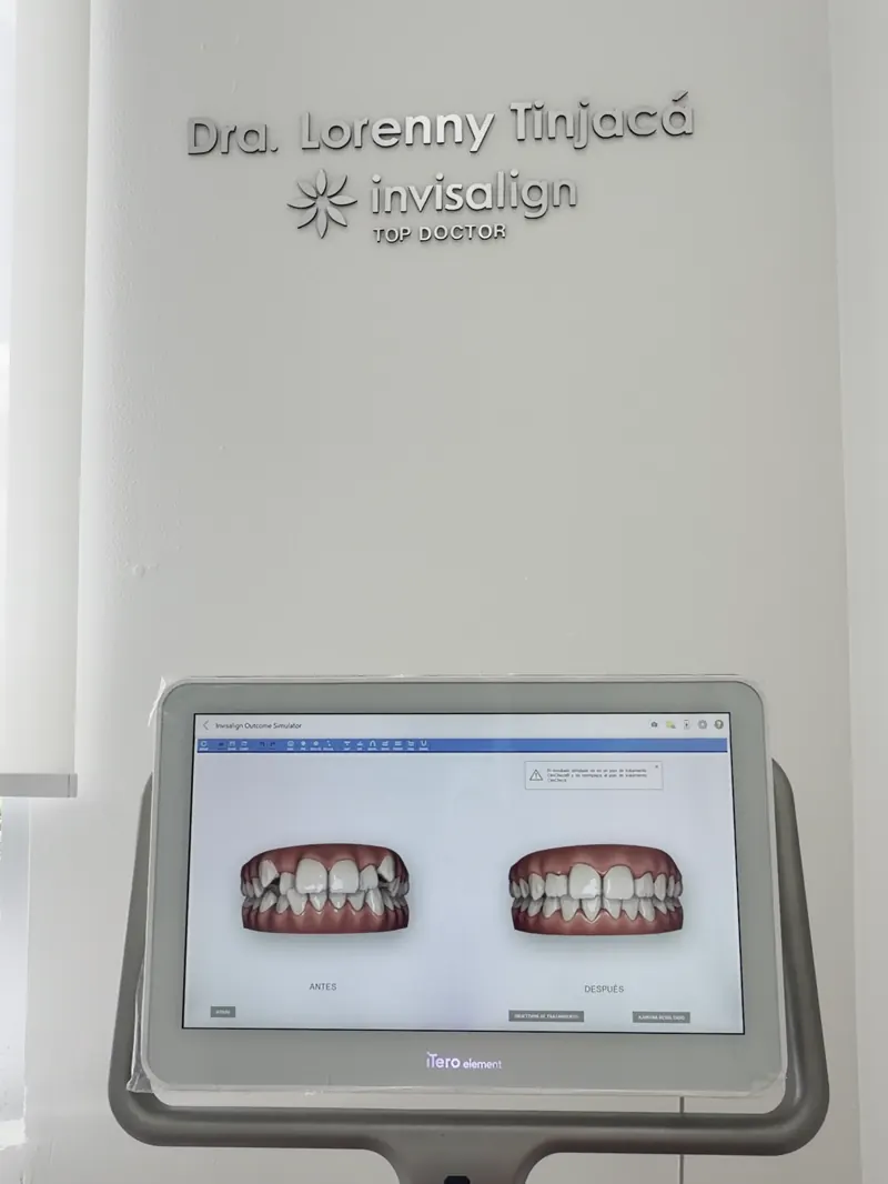 El escáner iTero del consultorio muestra la simulación de una sonrisa antes y después de Invisalign, bajo el letrero de la Dra. Lorenny Tinjacá como Invisalign Top Doctor